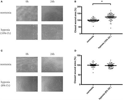 3-Mercaptopyruvate Sulfurtransferase, Not Cystathionine β-Synthase Nor Cystathionine γ-Lyase, Mediates Hypoxia-Induced Migration of Vascular Endothelial Cells